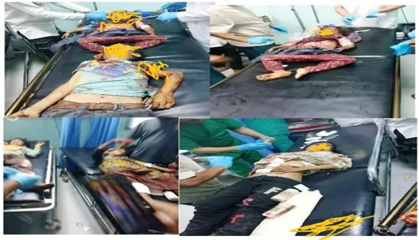 الضالع.. استشهاد 4 أطفال وجرح 9 آخرين بانفجار مقذوف حربي
