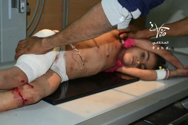 استشهاد مدني وإصابة أطفال بقصف حوثي استهدف منطقة الحميراء شرق تعز