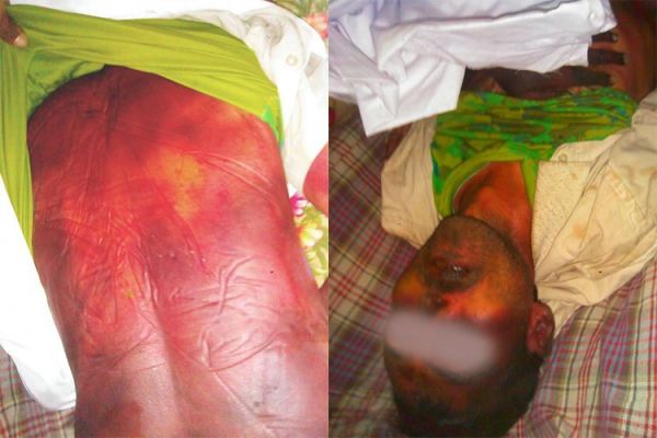 تقرير حقوقي يكشف مقتل (28) شخص تحت تعذيب مليشيات الحوثي
