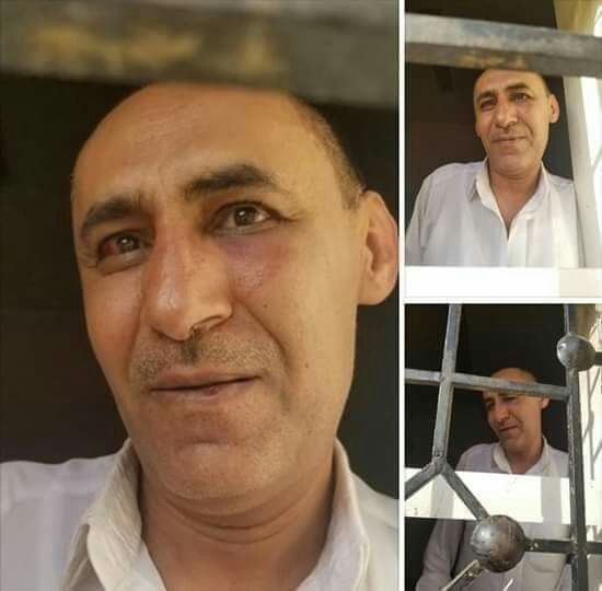 ضمن صراعات أجنحة المليشيا.. الحوثيون يفرجون عن قيادي في صفوفهم بعد اختطافه وتعذيبه