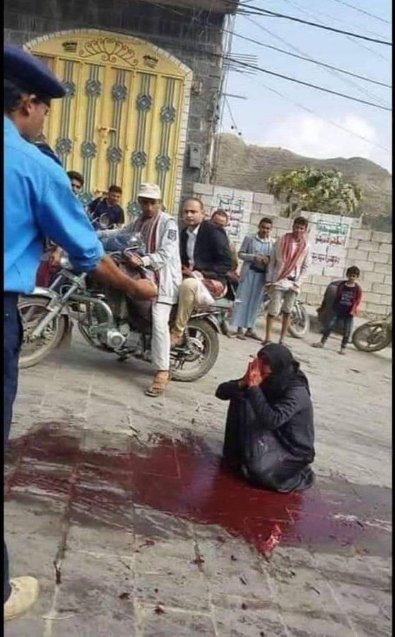 زوجته تتخضب بدمائه.. عناصر حوثية ترتكب جريمة قتل بشعة في أحد اسواق حجة