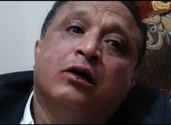 عناصر حوثية تعتدي على الصحفي مجلي الصمدي جوار منزله في صنعاء