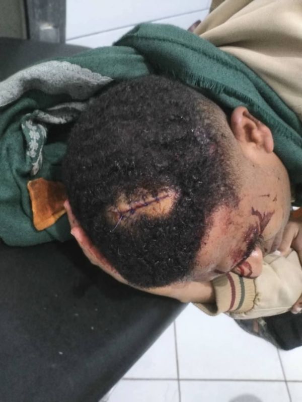  نقابة الصحفيين تدين الاعتداء المروع على مراسل "سهيل" في تعز