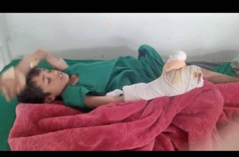  صنعاء.. إصابة طفل في نهم بمقذوف من مخلفات مليشيات الحوثي