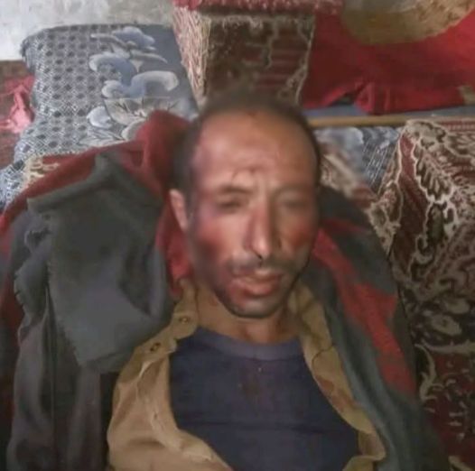 عراك دموي بالفؤوس يودي بحياة شخصين ويصيب اثنين من أسرة واحدة شرقي صنعاء