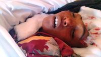 استشهاد طفل بقصف صاروخي لمليشيا الحوثي في الجوف استشهاد طفل بقصف صاروخي لمليشيا الحوثي في الجوف