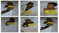 تحالف حقوقي: مقتل وإصابة أكثر من ألفي طفل برصاص الانقلابيين في تعز خلال 5 أشهر تحالف حقوقي: مقتل وإصابة أكثر من ألفي طفل برصاص الانقلابيين في تعز خلال 5 أشهر