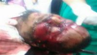 عدن: مسلحون مجهولون يغتالون إمام وخطيب جامع الصحابة بالمنصورة عدن: مسلحون مجهولون يغتالون إمام وخطيب جامع الصحابة بالمنصورة