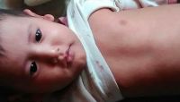 صنعاء: سكان منطقة "حريب نهم" يشكون من تفشي مرض "الحصبة" صنعاء: سكان منطقة "حريب نهم" يشكون من تفشي مرض "الحصبة"