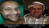 «أحمد».. مختطف لدى الحوثيين أصيب في قصف معسكر الشرطة العسكرية بصنعاء وترفض الميليشيا الافراج عنه «أحمد».. مختطف لدى الحوثيين أصيب في قصف معسكر الشرطة العسكرية بصنعاء وترفض الميليشيا الافراج عنه