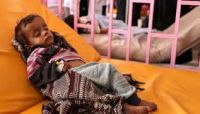 الصحة العالمية: 91 حالة وفاة بمرض الدفتيريا في اليمن خلال 6 أشهر الصحة العالمية: 91 حالة وفاة بمرض الدفتيريا في اليمن خلال 6 أشهر