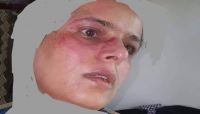 مليشيات الحوثي تعتدي على ناشطة بصنعاء بسبب منشوراتها على "فيسبوك" مليشيات الحوثي تعتدي على ناشطة بصنعاء بسبب منشوراتها على "فيسبوك"