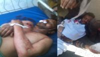 لرفضهم دفع جباية (الخُمس).. مقتل وإصابة 3 مواطنين برصاص مشرف حوثي في ذمار لرفضهم دفع جباية (الخُمس).. مقتل وإصابة 3 مواطنين برصاص مشرف حوثي في ذمار