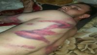 عصابة اجرامية تعتدي على مواطن بوحشية وسط صنعاء وتنهب مابحوزته من أموال عصابة اجرامية تعتدي على مواطن بوحشية وسط صنعاء وتنهب مابحوزته من أموال