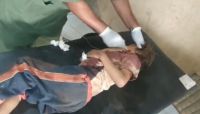 بقرار أممي.. إدراج "الحوثي" في اللائحة السوداء لمنتهكي حقوق الأطفال بقرار أممي.. إدراج "الحوثي" في اللائحة السوداء لمنتهكي حقوق الأطفال